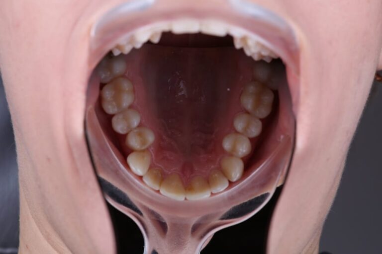 Пациент 3 - 6